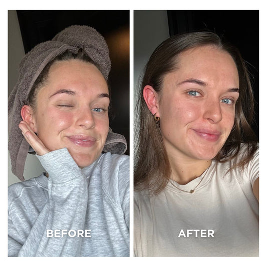 MILD SKIN DETOX